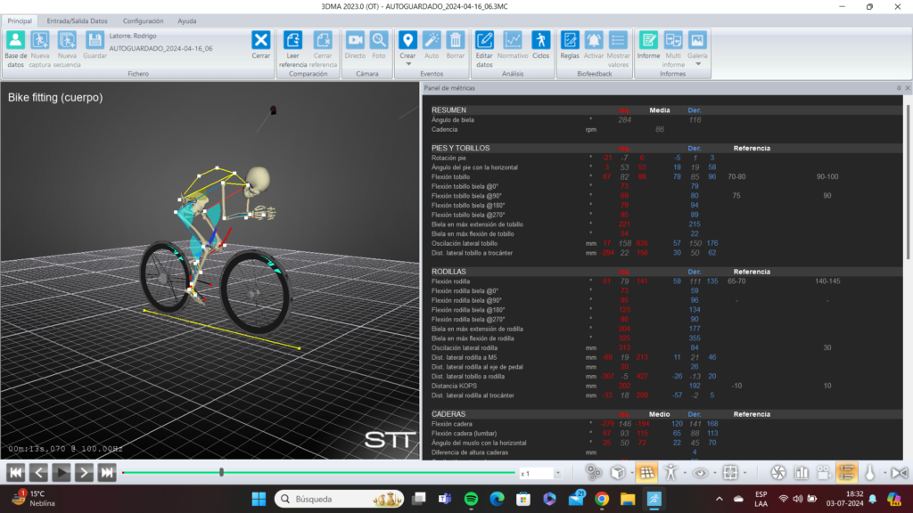 bikefitting